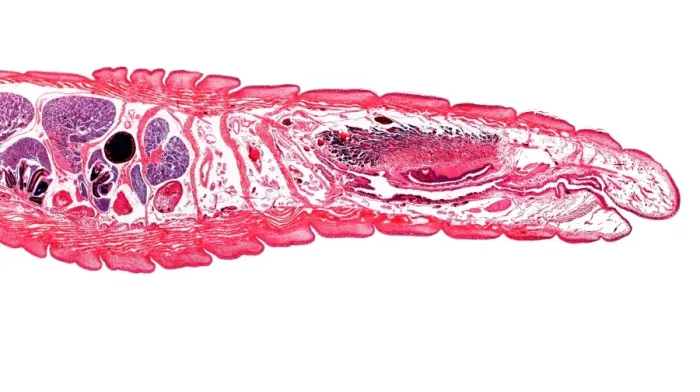 Framed Print : Longitudinal Section of Earthworm Print Framed Print : Longitudinal Section of Earthworm Print
