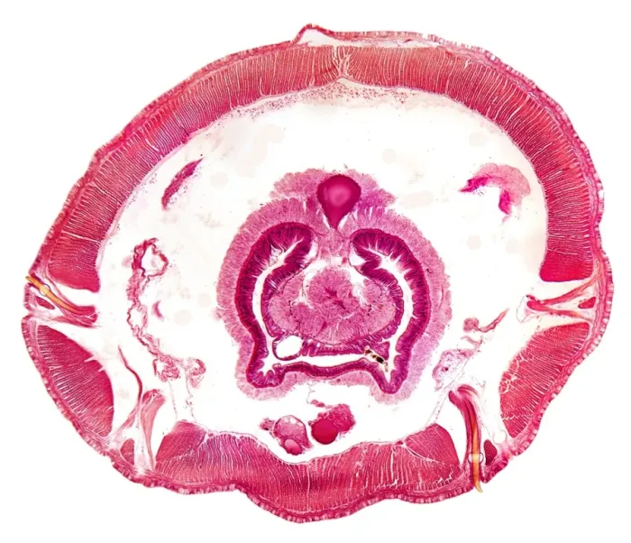Framed Print : Transverse Section of Earthworm Print Framed Print : Transverse Section of Earthworm Print