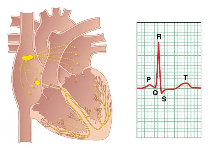 Framed Print : Electrical Conduction of the Heart Print Framed Print : Electrical Conduction of the Heart Print