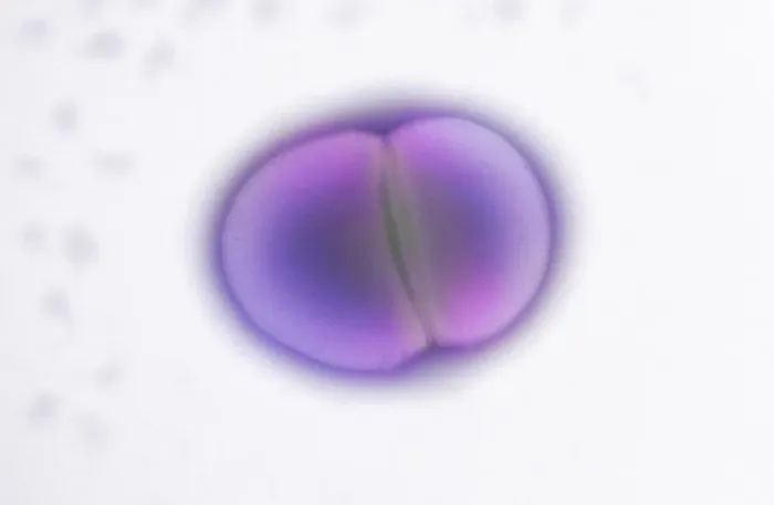 Framed Print : TEM Print of Enterococcus faecalis Dividing Cells