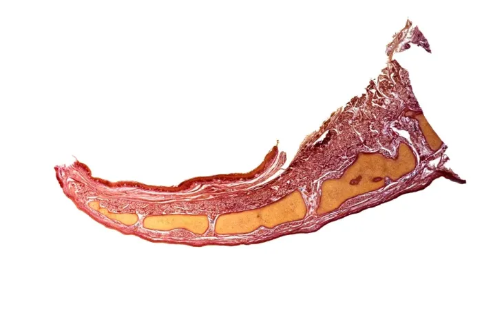 Framed Print : Longitudinal Section Epiglottis Print Framed Print : Longitudinal Section Epiglottis Print