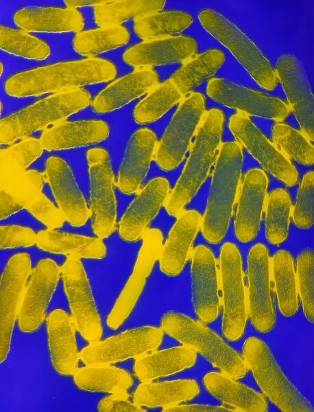 Escherichia coli 0157: H7 bacteria