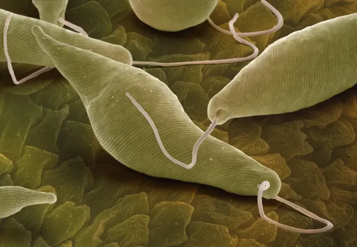 Framed Print : Euglena gracilis SEM Print Framed Print : Euglena gracilis SEM Print