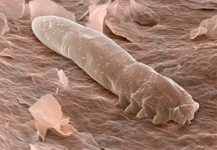 Framed Print : SEM Print of Eyelash Mite Framed Print : SEM Print of Eyelash Mite
