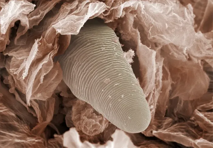 Framed Print : Eyelash mite tail, SEM Print Framed Print : Eyelash mite tail, SEM Print
