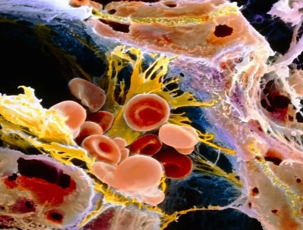 F. colour SEM of macrophage & blood cells in liver