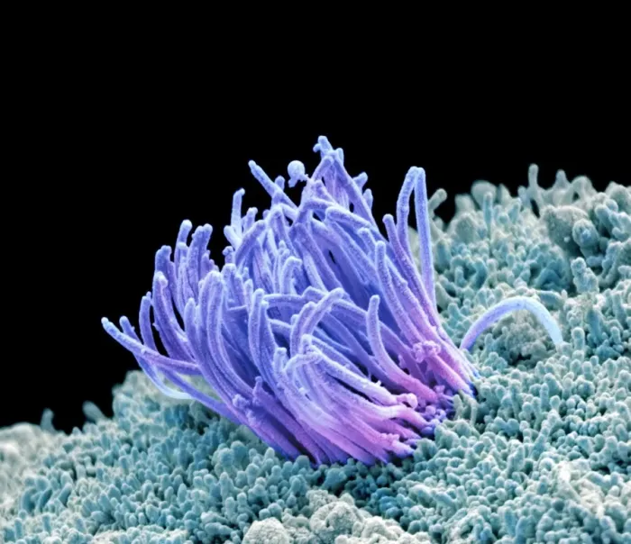 Framed Print : Coloured SEM Print of Fallopian Tube Lining Framed Print : Coloured SEM Print of Fallopian Tube Lining