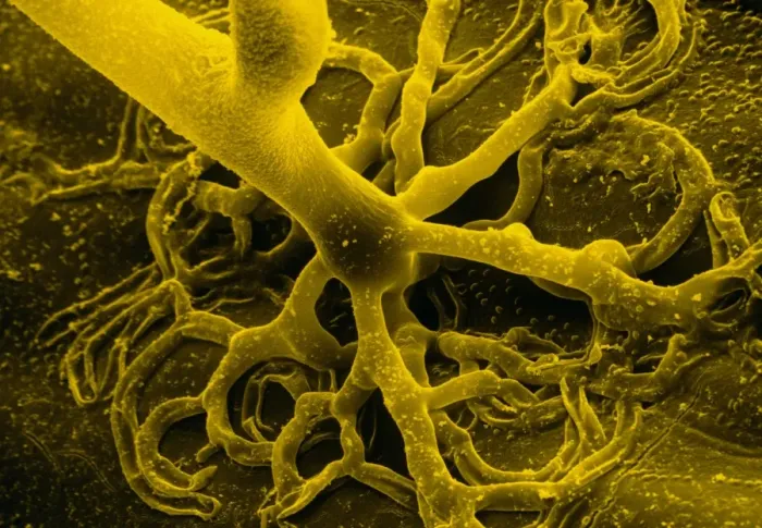 Framed Print : False colour scanning electron micrograph of rhizoids Print Framed Print : False colour scanning electron micrograph of rhizoids Print