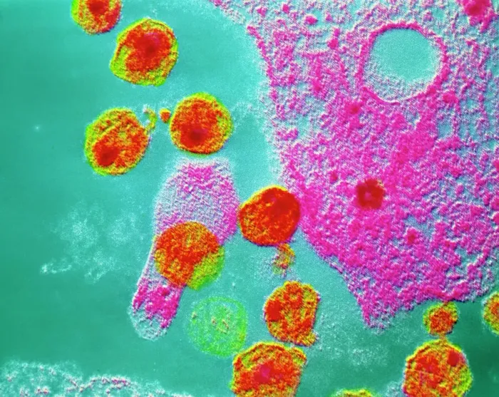 Framed Print : False-colour transmission electron micrograph Print of AIDS virus inside T-cell Framed Print : False-colour transmission electron micrograph Print of AIDS virus inside T-cell