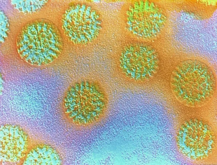 Framed Print : False-colour TEM Print of Rotavirus Particles Framed Print : False-colour TEM Print of Rotavirus Particles