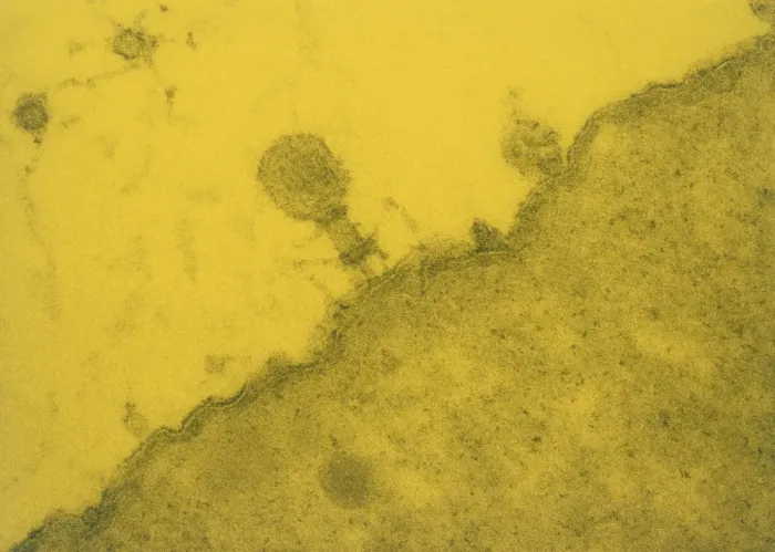 Framed Print : False-colour TEM Print of T4 Bacteriophage in E. coli Framed Print : False-colour TEM Print of T4 Bacteriophage in E. coli