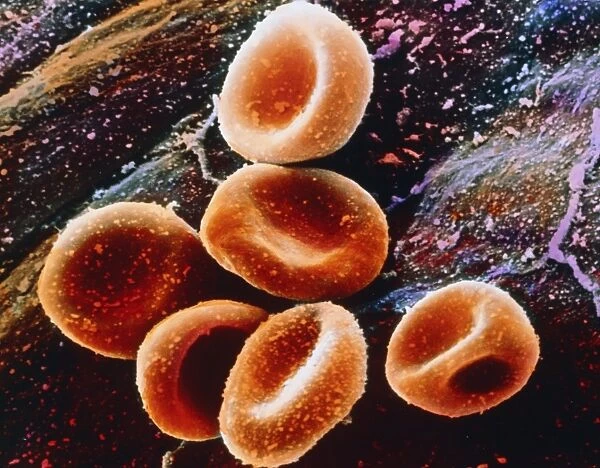 False-colour SEM of a group of red blood cells