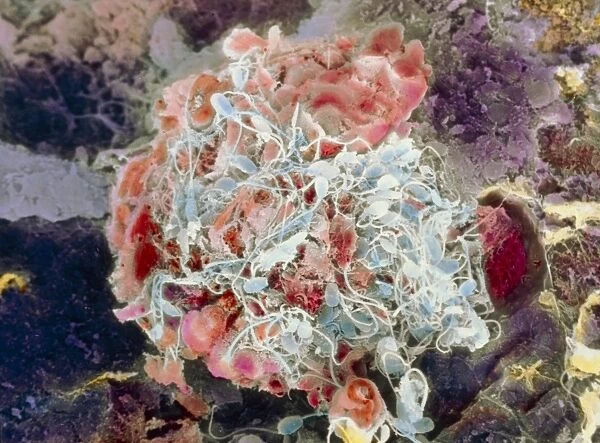 False-colour SEM of human egg surrounded by sperm