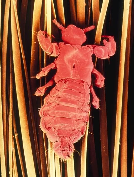 False-colour SEM of a human head louse