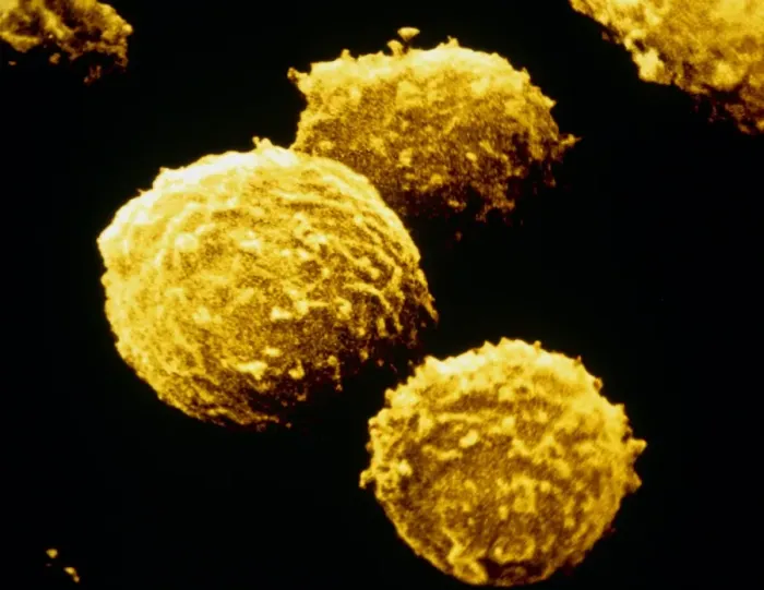 Framed Print : False-colour SEM Print of T-lymphocytes Framed Print : False-colour SEM Print of T-lymphocytes