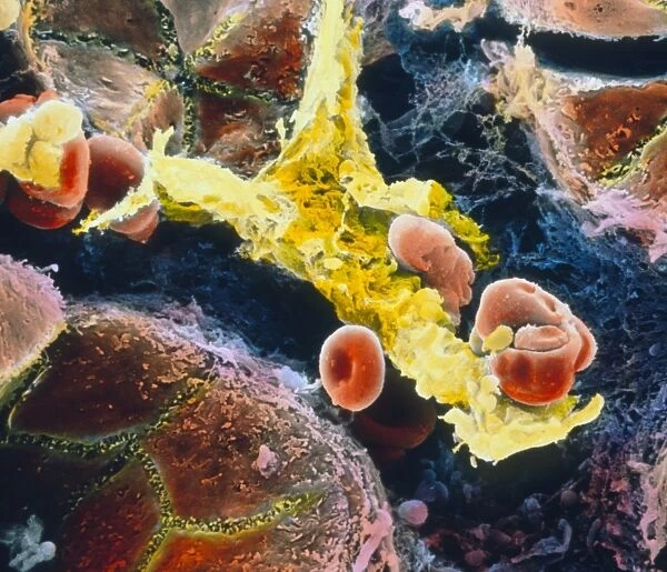 False-colour SEM of Kupffer cell in liver