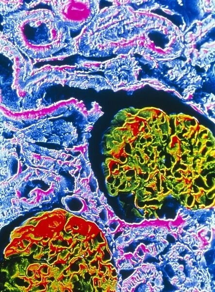 False-colour SEM showing two renal glomeruli