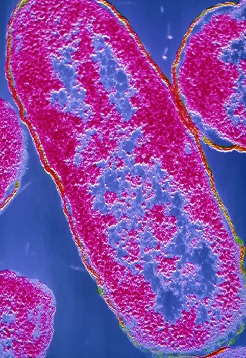 Framed Print : False-colour TEM Print of E. coli Bacteria Framed Print : False-colour TEM Print of E. coli Bacteria