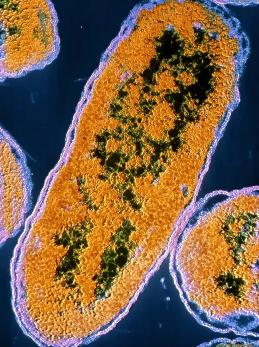Framed Print : False-colour TEM Print of E. coli Bacteria Framed Print : False-colour TEM Print of E. coli Bacteria