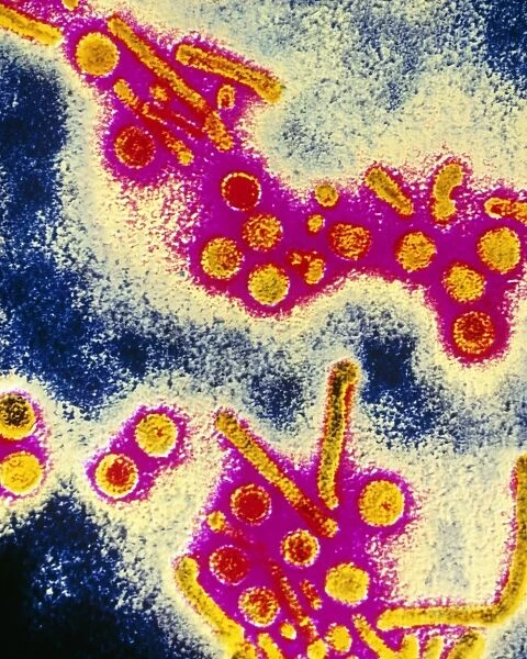 False-colour TEM of hepatitis B virus particles