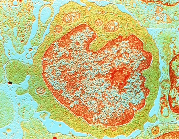 Framed Print : False-colour TEM Print of a Human Lymphocyte Framed Print : False-colour TEM Print of a Human Lymphocyte