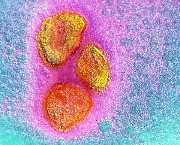 False-colour TEM of mumps virus particles