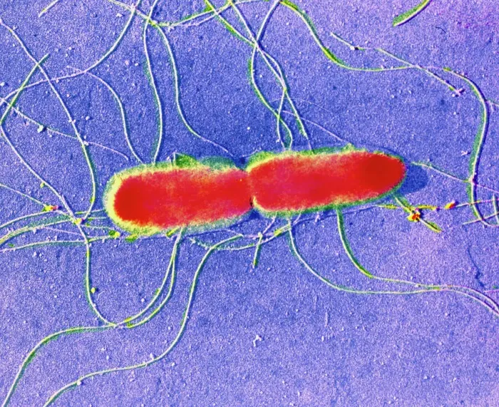Framed Print : False-colour TEM Print of Salmonella typhi Bacteria Framed Print : False-colour TEM Print of Salmonella typhi Bacteria