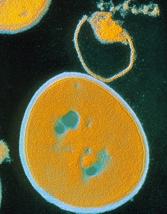 Framed Print : False-colour TEM Print of Staphylococcus aureus Bacteria Framed Print : False-colour TEM Print of Staphylococcus aureus Bacteria