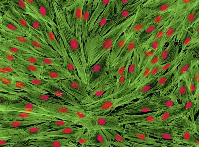 Framed Print : Fibroblast cells, x850 print Framed Print : Fibroblast cells, x850 print