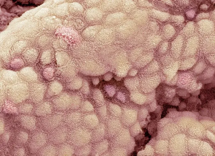 Framed Print : Gallbladder Surface Print, SEM Framed Print : Gallbladder Surface Print, SEM