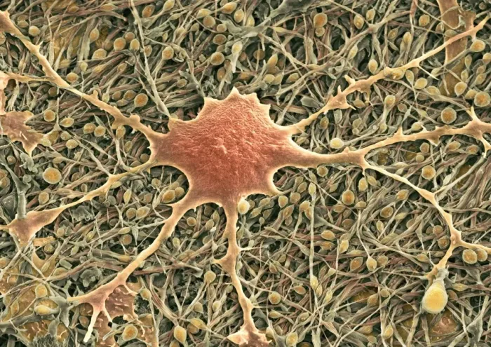 Framed Print : Glial Cells Print, SEM Image Framed Print : Glial Cells Print, SEM Image