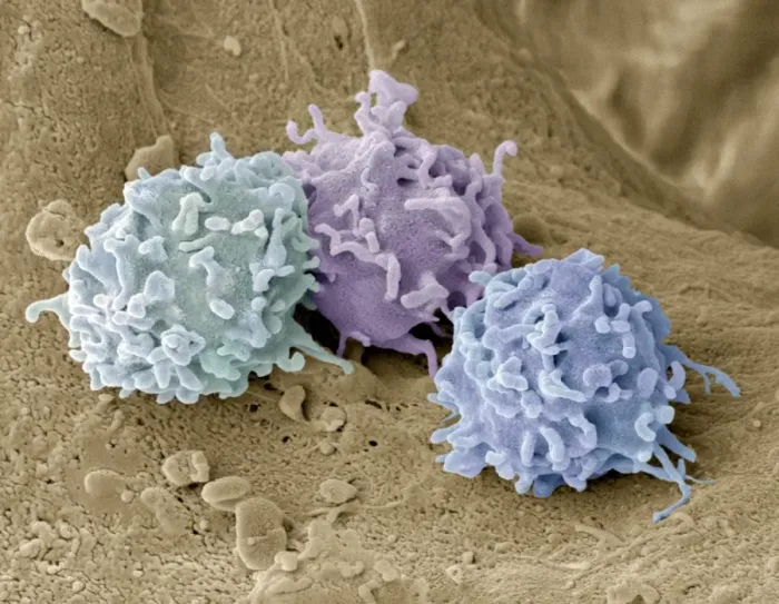 Framed Print : Granulocytes Print, SEM Image Framed Print : Granulocytes Print, SEM Image