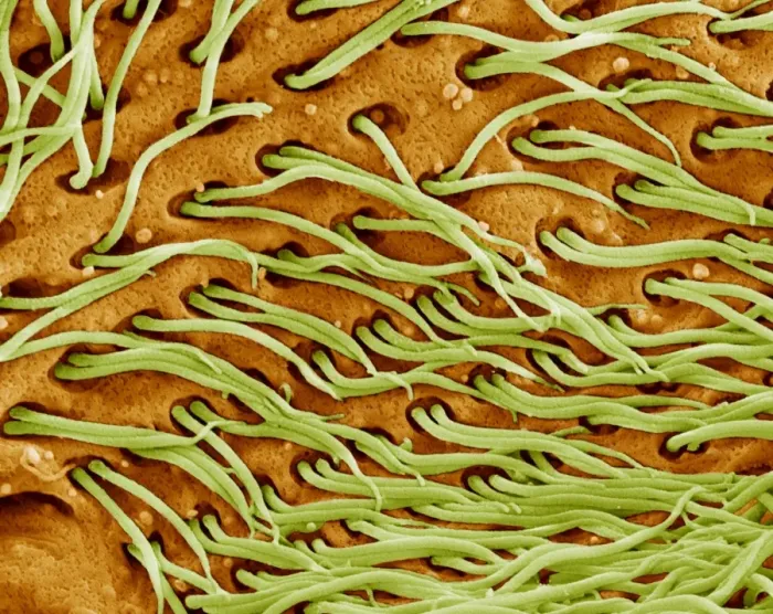Framed Print : Protozoan Cilia Print, SEM Image of Microscopic Hairs Framed Print : Protozoan Cilia Print, SEM Image of Microscopic Hairs