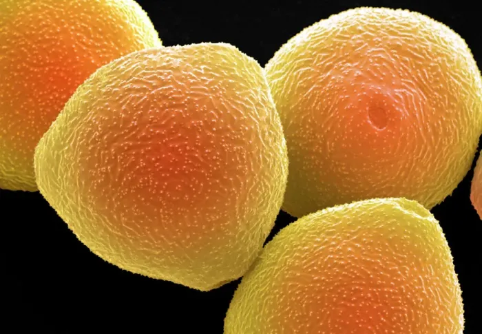 Framed Print : Hazel Pollen Grains Print Framed Print : Hazel Pollen Grains Print
