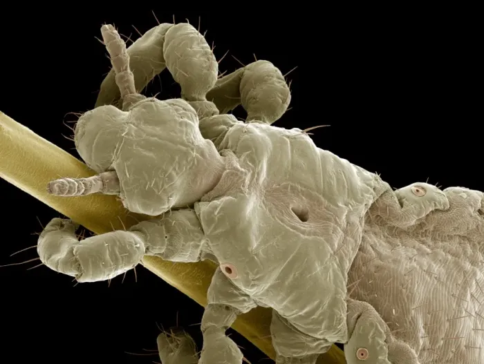 Framed Print : Print of Head Louse SEM Framed Print : Print of Head Louse SEM