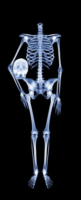 Framed Print : Skeleton X-ray Print Framed Print : Skeleton X-ray Print