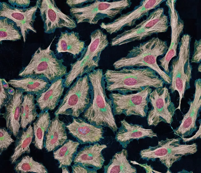 Framed Print : HeLa cells Print, x1000 magnification Framed Print : HeLa cells Print, x1000 magnification
