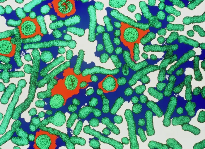 Framed Print : Hepatitis B virus print Framed Print : Hepatitis B virus print
