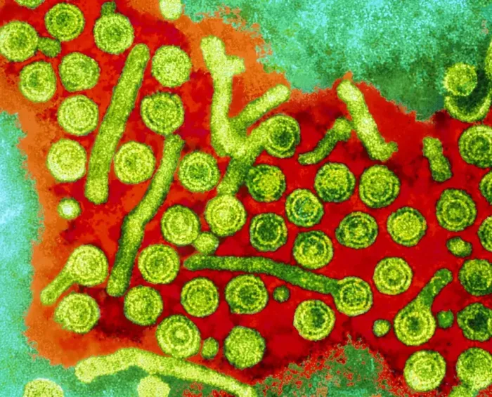 Framed Print : TEM Print of Hepatitis B Viruses Framed Print : TEM Print of Hepatitis B Viruses