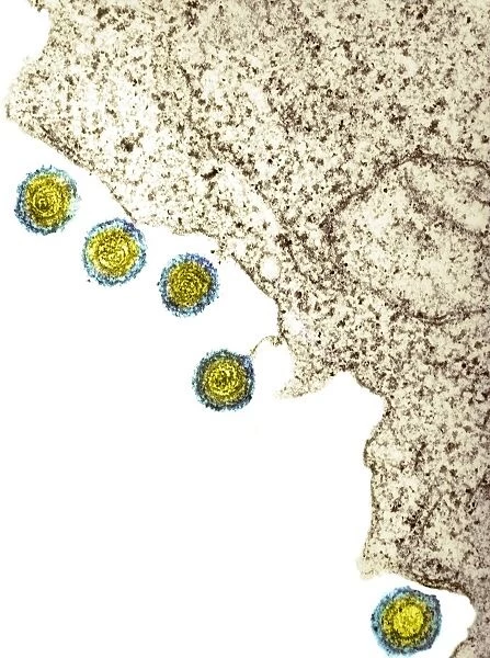 Herpes virus particles, TEM