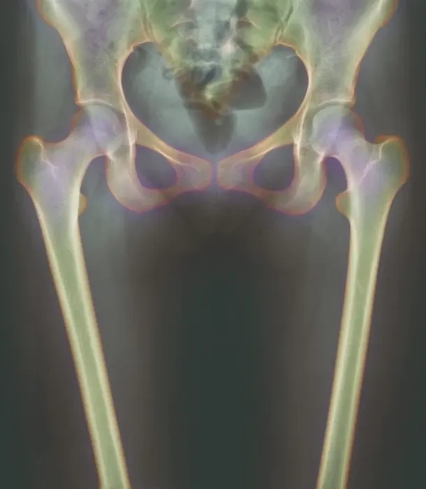 Framed Print : Coloured X-ray Hip Joint Print Framed Print : Coloured X-ray Hip Joint Print