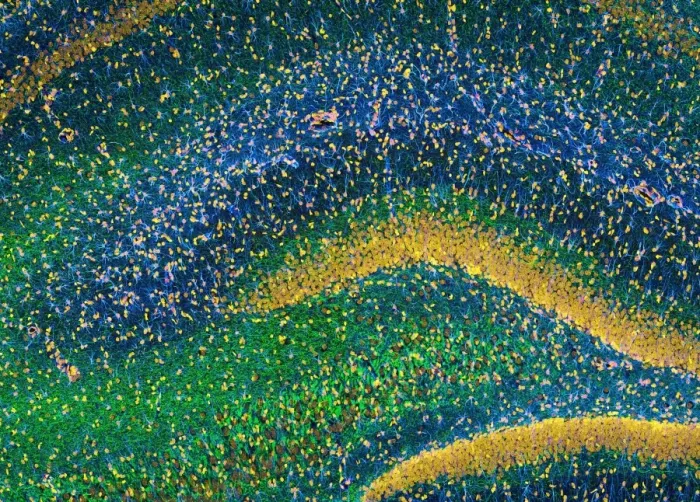 Framed Print : Light Micrograph Print of Rat Hippocampus Tissue Framed Print : Light Micrograph Print of Rat Hippocampus Tissue