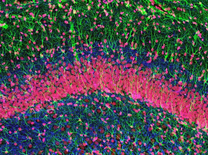 Framed Print : Hippocampus Brain Tissue Print Framed Print : Hippocampus Brain Tissue Print