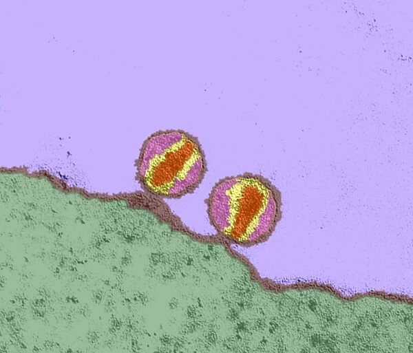 HIV viruses, TEM