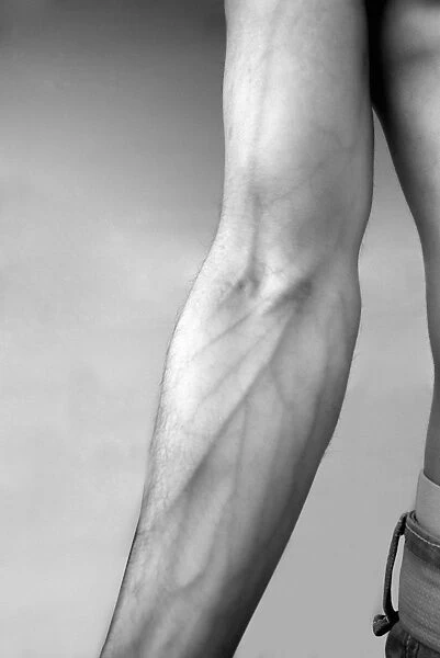 Human arm, infrared image C013  /  7325