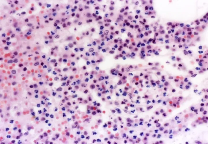 Framed Print : Human Blood Cells Print, Light Micrograph Framed Print : Human Blood Cells Print, Light Micrograph