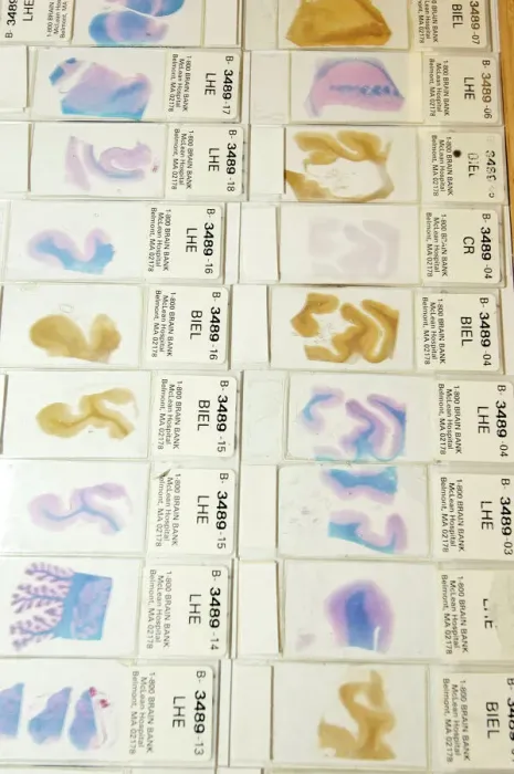 Framed Print : Human Brain Microscope Slide Print Framed Print : Human Brain Microscope Slide Print