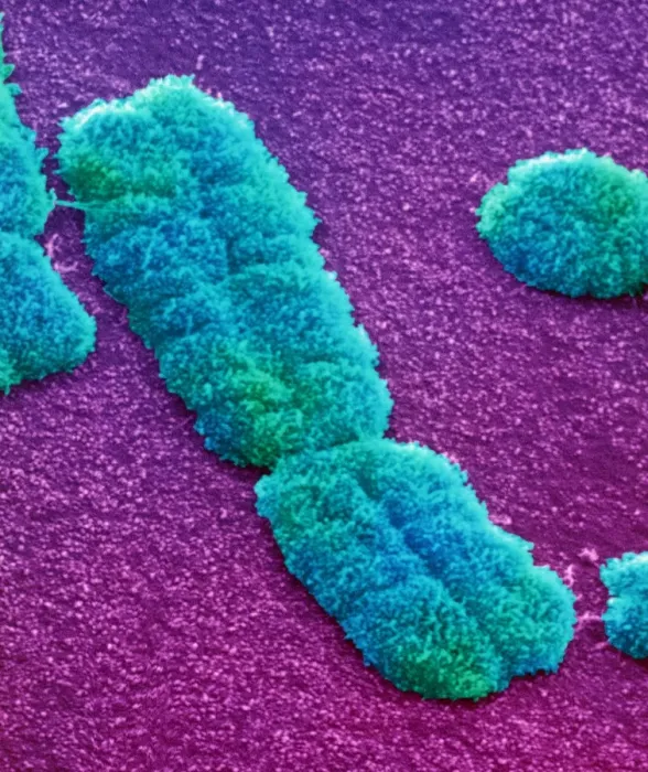 Framed Print : Human Chromosome Print (SEM) Framed Print : Human Chromosome Print (SEM)