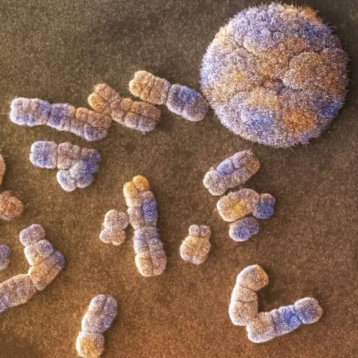 Framed Print : Human Chromosomes and Nucleus Print, SEM Framed Print : Human Chromosomes and Nucleus Print, SEM