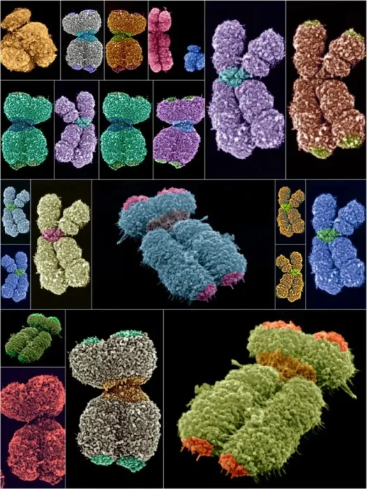 Framed Print : Human Chromosomes Print, SEMs Framed Print : Human Chromosomes Print, SEMs